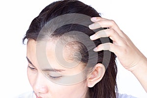 Woman serious hair loss problem for health care shampoo and beauty product concept