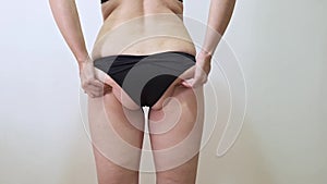 Woman shacking her fat buttock with cellulite, showing hanging fat close up