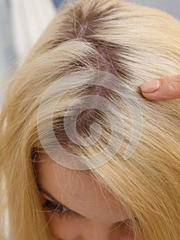 Woman showing blonde hair roots