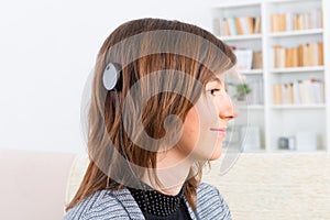 Woman showing cochlear implant