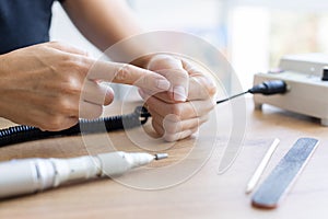 Woman showing cracked broken nails. Manicure concept. photo