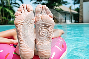 Woman showing feet got wrinkly