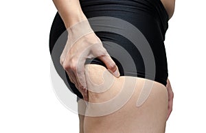 Woman showing her leg with cellulite