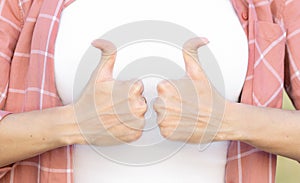 Woman showing thumbs up with douple-joint thumbs photo