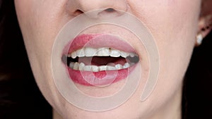 Woman shows off her chipped teeth. Bruxism, stress, malocclusion.