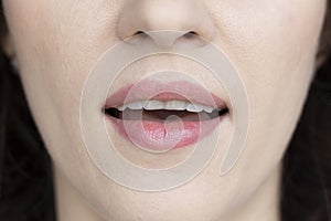 Woman shows off her chipped teeth. Concept of dental treatment, straight bite. Bruxism