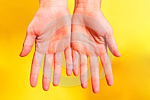 Woman shows the palms of her hands with calluses from hard work,  on yellow background photo