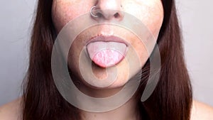 Woman shows unhealthy tongue, white tongue. A common symptom of a candida albicans yeast infection or stomatitis. health
