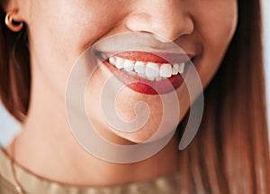 Woman, smile and closeup of dental wellness, healthcare and dentist of female veneers. Happy, cosmetics and young person