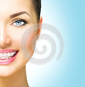 Woman smiling with ceramic braces on teeth