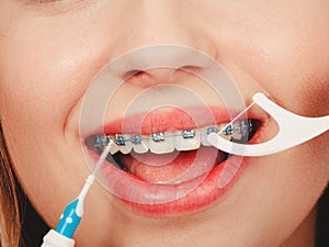 Woman smiling cleaning teeth with braces