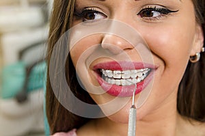 woman smiling at dental brace checkup