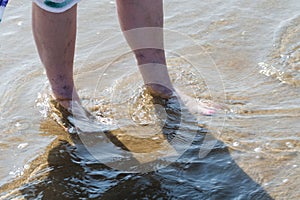 Woman with spider veins on the leg