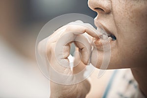 Woman in stress gnawing her nails photo