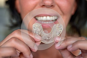 Woman suffering from bruxism holding up a guard