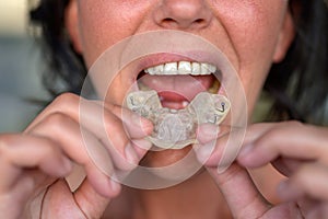 Woman suffering from bruxism holding up a guard