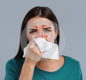 Woman suffering from runny nose as allergy symptom. Sinuses illustration