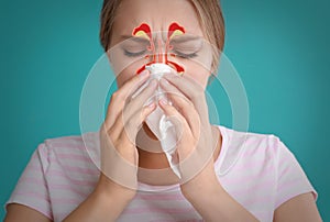 Woman suffering from runny nose as allergy symptom. Sinuses illustration
