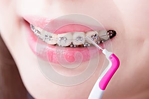 Woman take interdental brush