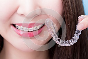 Woman take invisible braces