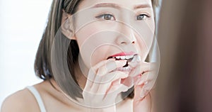 Woman take off invisible braces