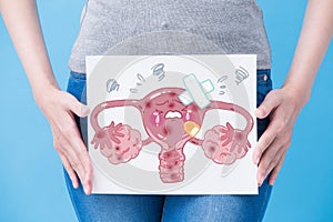Woman with unhealth uterus photo