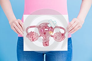 Woman take uterus billboard