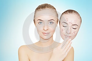 Woman takes away mask with acne and pimples,blue background