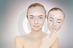 Woman takes away mask with acne and pimples,grey background