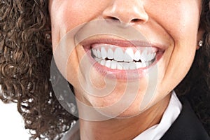 Woman teeth