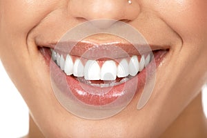 Woman teeth