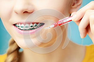 Woman with teeth braces using interdental brush