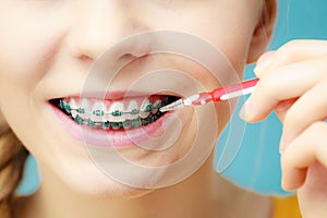 Woman with teeth braces using interdental brush