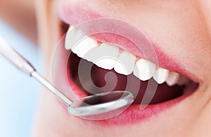 Woman teeth and a dentist mirror photo