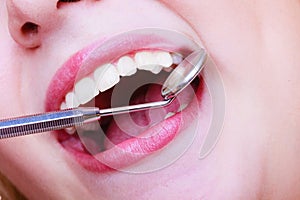 Woman teeth and dentist mouth mirror