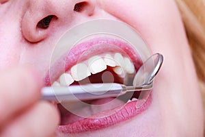 Woman teeth and dentist mouth mirror