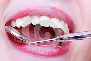 Woman teeth and dentist mouth mirror