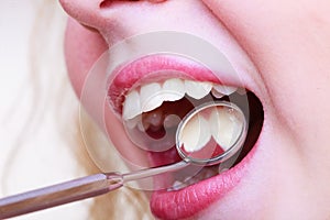 Woman teeth and dentist mouth mirror