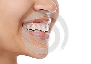 Woman, teeth and mouth for dental care, hygiene or treatment against a white studio background. Closeup of female person