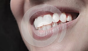 Woman teeth smiling mouth