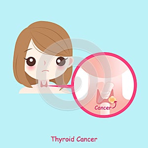 Woman with thyroid cancer