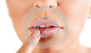 Woman touching her lips with herpes