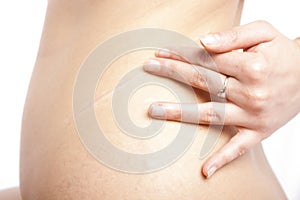 Woman touching her scar