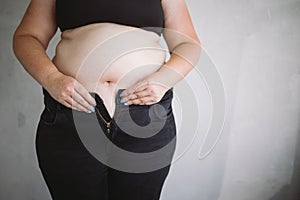 Woman trying to button tight pants on obese belly