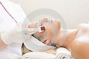 The woman undergoes the procedure of medical micro needle therapy