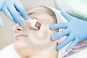 The woman undergoes the procedure of medical micro needle therapy with a modern