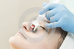 The woman undergoes the procedure of medical micro needle therapy with a modern photo