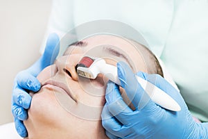 woman undergoes the procedure of medical micro needle therapy with a modern medical instrument derma roller