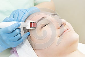 Woman undergoes the procedure of medical micro needle therapy with a modern medical instrument derma roller