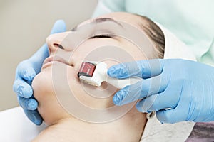 Woman undergoes the procedure of medical micro needle therapy with a modern medical instrument derma roller.